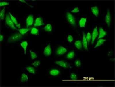 Immunocytochemistry/ Immunofluorescence: RPS5 Antibody (4H3) [H00006193-M02]