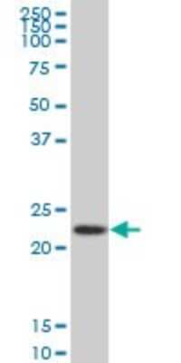Western Blot: RPS5 Antibody (4H3) [H00006193-M02]