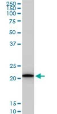 Western Blot: RPS5 Antibody (4H3) [H00006193-M02]