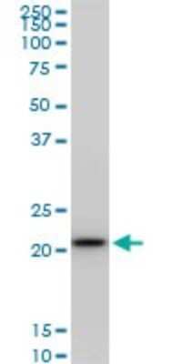 Western Blot: RPS5 Antibody (4H3) [H00006193-M02]