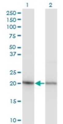 Western Blot: RPS5 Antibody (4H3) [H00006193-M02]