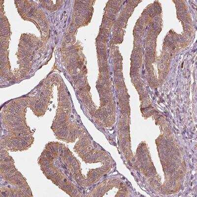 Immunohistochemistry: RPS5 Antibody [NBP2-56843]
