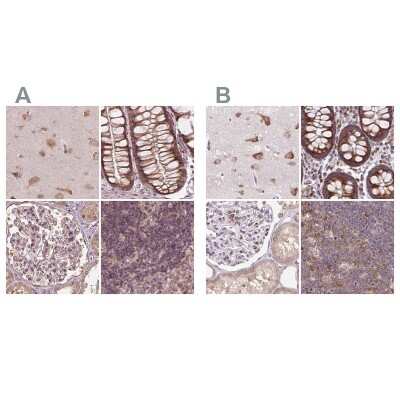 Immunohistochemistry-Paraffin: RPS5 Antibody [NBP2-56843]