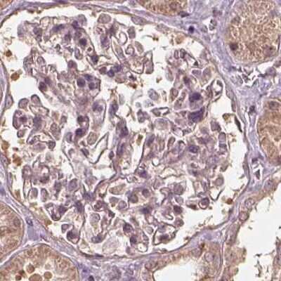 Immunohistochemistry-Paraffin: RPS5 Antibody [NBP2-56843]