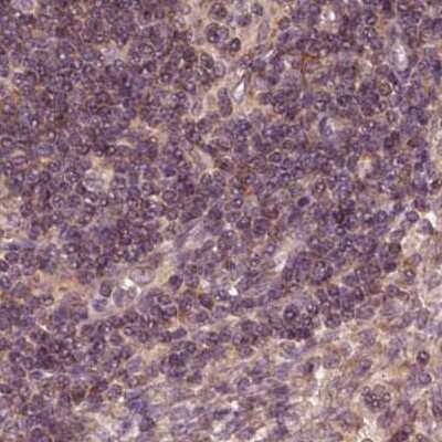 Immunohistochemistry-Paraffin: RPS5 Antibody [NBP2-56843]