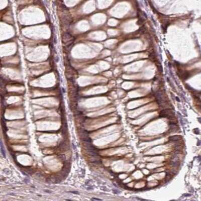 Immunohistochemistry-Paraffin: RPS5 Antibody [NBP2-56843]