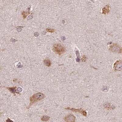 Immunohistochemistry-Paraffin: RPS5 Antibody [NBP2-56843]