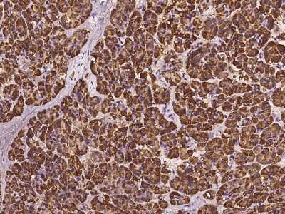 Immunoprecipitation: RPS5 Antibody [NBP2-97627]