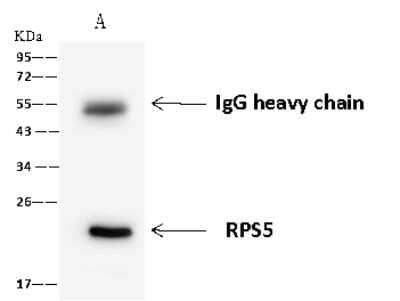 Immunoprecipitation: RPS5 Antibody [NBP2-97627]