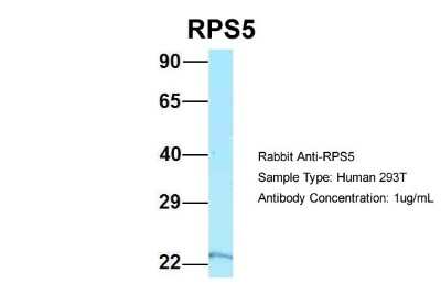 Western Blot: RPS5 Antibody [NBP1-98403]