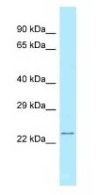 Western Blot: RPS5 Antibody [NBP1-98404]