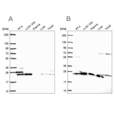 Western Blot: RPS5 Antibody [NBP2-49198]