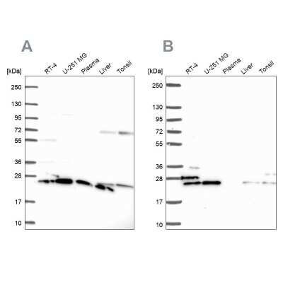 Western Blot: RPS5 Antibody [NBP2-56843]