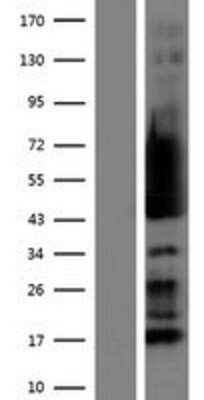 Western Blot: RPS5 Overexpression Lysate [NBP2-08703]