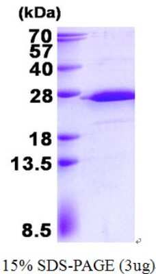 SDS-PAGE: Recombinant Human RPS5 His Protein [NBP2-23437]