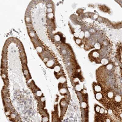Immunohistochemistry-Paraffin: RPS6KC1 Antibody [NBP1-83141]
