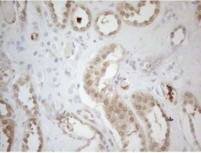 Immunohistochemistry: RPS6KC1 Antibody (OTI10F11) - Azide and BSA Free [NBP2-73946]