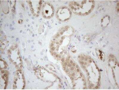 Immunohistochemistry-Paraffin: RPS6KC1 Antibody (OTI10F11) [NBP2-45635]