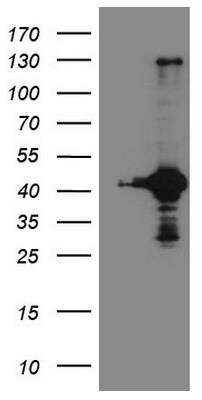 Western Blot: RPS6KC1 Antibody (OTI10F11) [NBP2-45635]