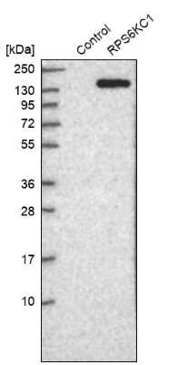 Western Blot: RPS6KC1 Antibody [NBP1-83141]