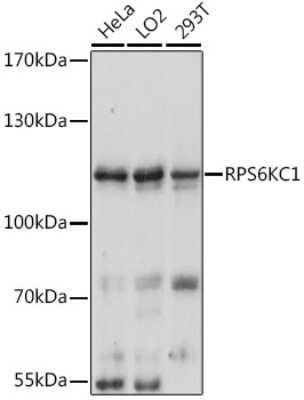 Western Blot: RPS6KC1 AntibodyAzide and BSA Free [NBP2-94674]