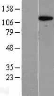 Western Blot: RPS6KC1 Overexpression Lysate [NBL1-15576]