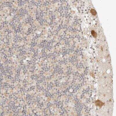 Immunohistochemistry: RPS6KL1 Antibody [NBP1-81225]