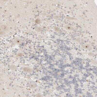 Immunohistochemistry: RPS6KL1 Antibody [NBP1-81226]