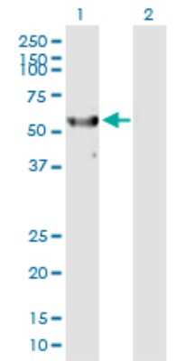 Western Blot: RPS6KL1 Antibody [H00083694-B01P]