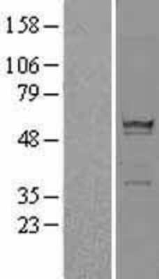 Western Blot: RPS6KL1 Overexpression Lysate [NBL1-15577]