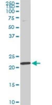 Western Blot: RPS7 Antibody (3G4) [H00006201-M03]