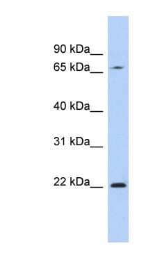 Western Blot: RPS7 Antibody [NBP1-57394]