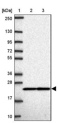 Western Blot: RPS7 Antibody [NBP2-33793]