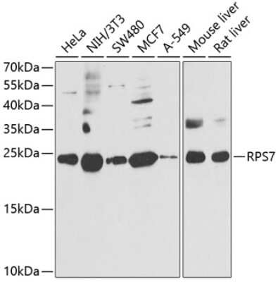 Western Blot: RPS7 AntibodyBSA Free [NBP2-94119]