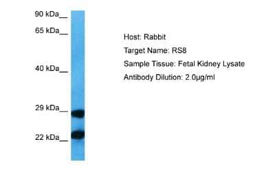 Western Blot: RPS8 Antibody [NBP2-86785]