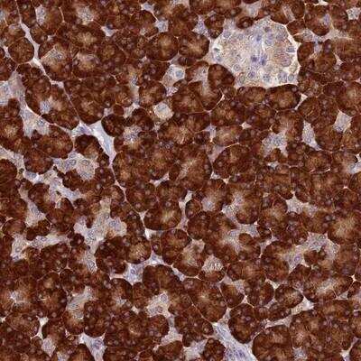 Immunohistochemistry-Paraffin: RPS9 Antibody [NBP2-13265]