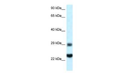 Western Blot: RPS9 Antibody [NBP2-88191]