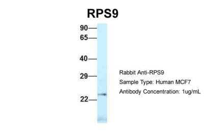 Western Blot: RPS9 Antibody [NBP2-88192]