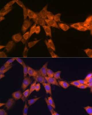 Immunocytochemistry/ Immunofluorescence: RPSA Antibody (2Q8Q6) [NBP3-16624]