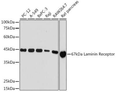 Western Blot: RPSA Antibody (2Q8Q6) [NBP3-16624]