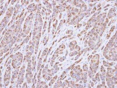 Immunohistochemistry-Paraffin: p40 Antibody [NBP1-32956]