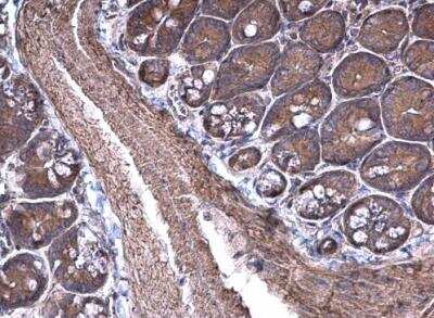 Immunohistochemistry-Paraffin: RPSA Antibody [NBP1-33002]