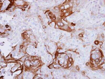 Immunohistochemistry-Paraffin: RPSA Antibody [NBP1-33002]
