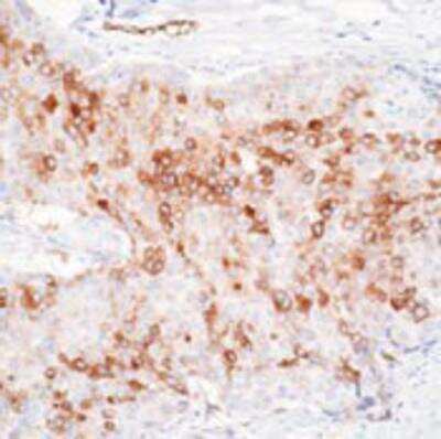 Immunohistochemistry-Paraffin: RPSA Antibody (MLuC5) [NB200-631]