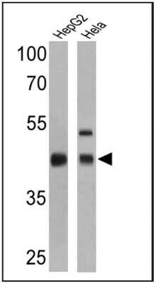 Western Blot: RPSA Antibody (MLuC5) [NB200-631]