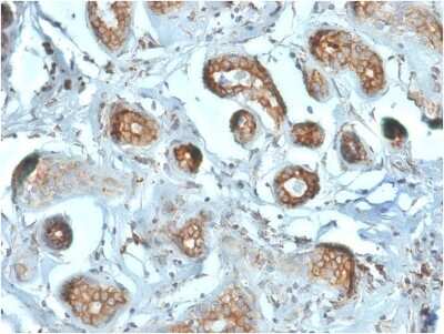 Immunohistochemistry-Paraffin: RPSA Antibody (RPSA/2699) [NBP2-79720]