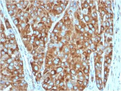 Immunohistochemistry-Paraffin: RPSA Antibody (RPSA/2699) [NBP2-79720]