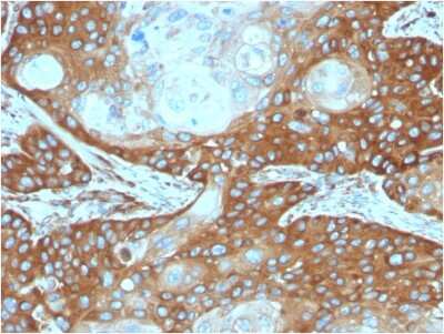 Immunohistochemistry-Paraffin: RPSA Antibody (RPSA/2699) [NBP2-79720]