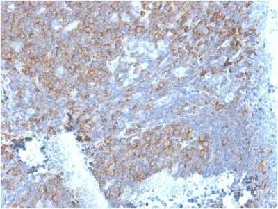 Immunohistochemistry-Paraffin: RPSA Antibody (RPSA/2699) [NBP2-79720]