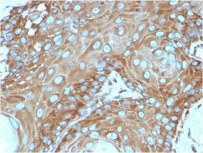 Immunohistochemistry-Paraffin: RPSA Antibody (RPSA/2699) [NBP2-79720]